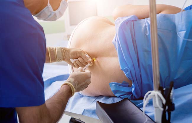 Patient undergoing Cervical and Thoracic Transforaminal Epidurals at ReMeDy Medical Group