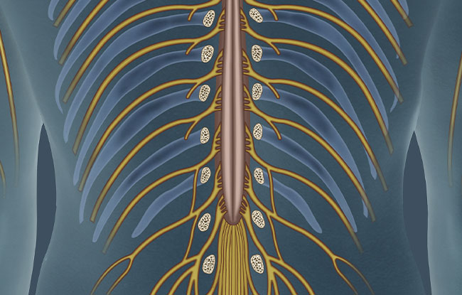 Patient undergoing Splanchnic Nerve Block at ReMeDy Medical Group